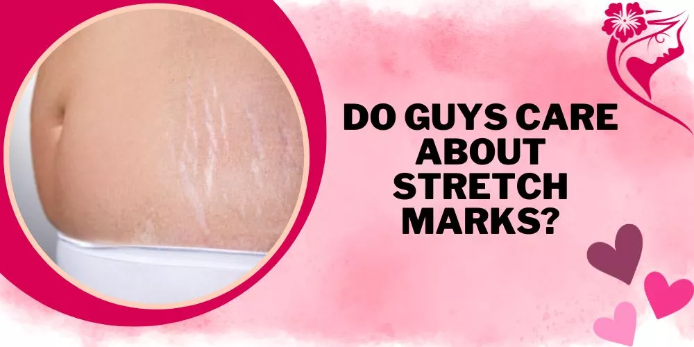 Do guys care about stretch marks
