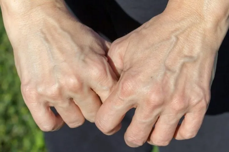 Veiny Hands- Not Just an Aesthetic Choice